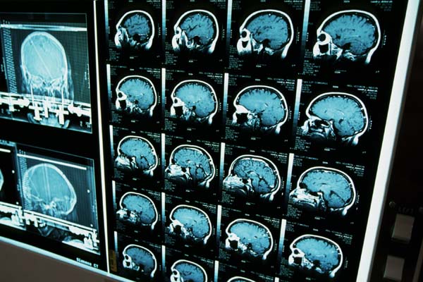 Oncology Medical Billing and Coding Services in Florida, USA